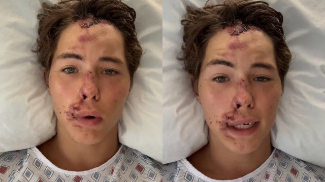 TikToker Caleb Coffee cai de um penhasco no Havai: "Quase morri"