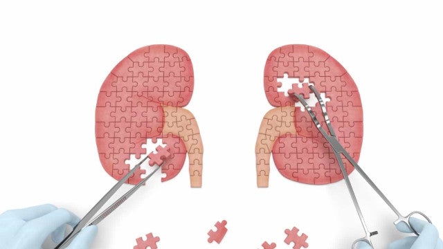 Menina de 8 anos é a primeira transplantada a não precisar de medicação