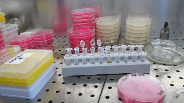 Surto da doença da urina preta gera alerta no Amazonas