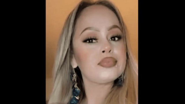 Mulher obrigada a amputar braços e pernas após comer peixe mal assado