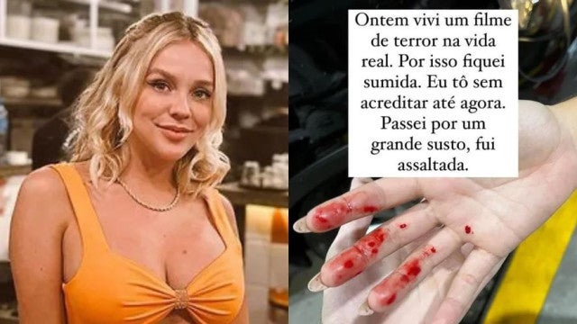 Gabi Lopes é assaltada em SP e mostra ferimentos: "filme de terror"