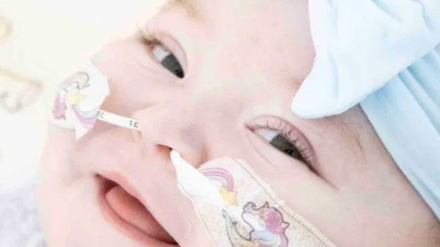 Menina nasce com doença rara que destrói ossos e é única no mundo