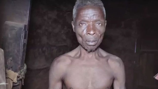 Fobia isola ruandês de mulheres há 55 anos: "Deixam-me com medo"