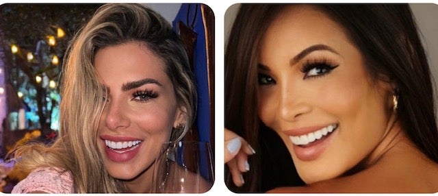 Erika Schneider e Carol Nakamura trocam lentes de contato dental para ter o sorriso mais natural; saiba mais sobre a tendência