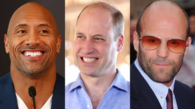 É dos carecas que elas gostam mais? Calvos bonitões (outros nem tanto)!