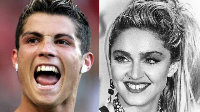 Os sorrisos das celebridades no início da fama!