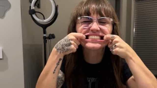 Influenciadora norte-americana viraliza com conteúdo sobre dentaduras