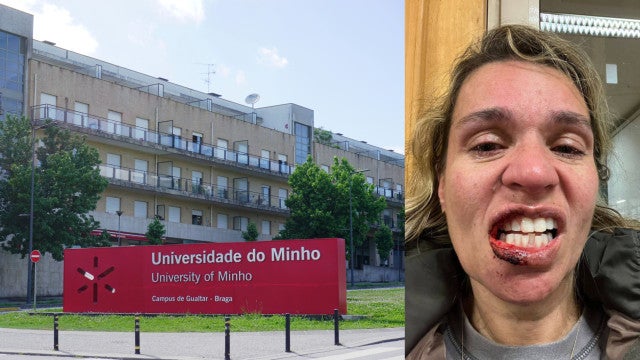 Estudante brasileira acusa colega local de agredi-la com socos em universidade de Portugal