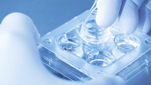 Mulher de 62 anos é autorizada a retirar esperma do marido que morreu