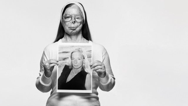 Mulher atacada com ácido vira capa de revista de moda; veja as imagens