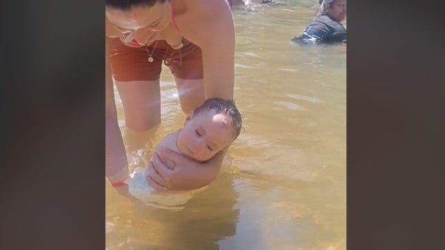 Bebê com doença rara emociona internet; menina nasceu sem pernas e braços