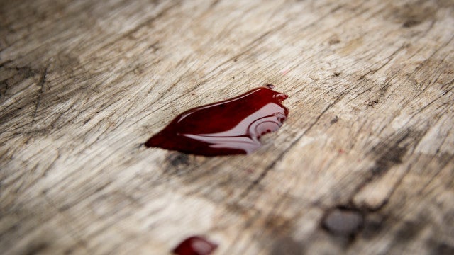 Ladrão sangra até a morte após chutar janela para invadir casa na Argentina