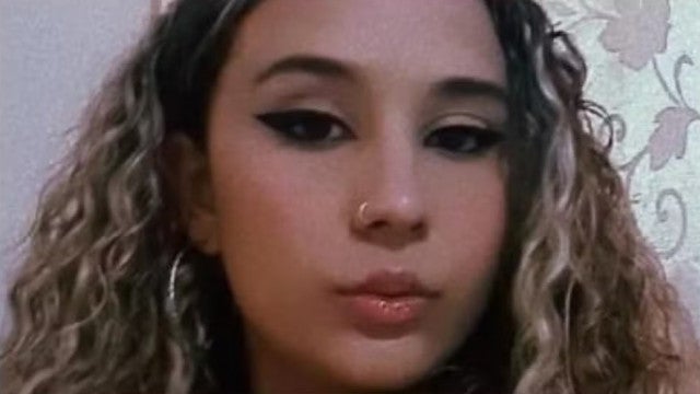 Fissura que ocorreu com jovem após encontro com jogador é incomum, dizem médicos