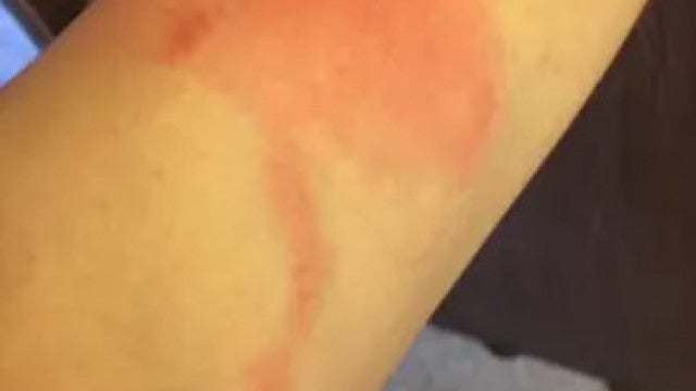 Estado do Alasca confirma primeiro caso fatal do vírus Alaskapox