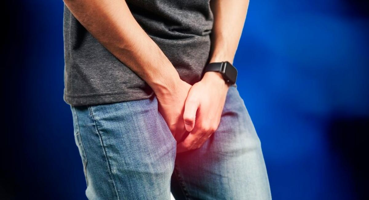 Sociedade Brasileira de Urologia e o Ministério da Saúde divulgam a prevenção do câncer de pênis