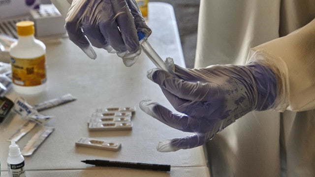 SUS incorpora teste para detecção de HPV em mulheres