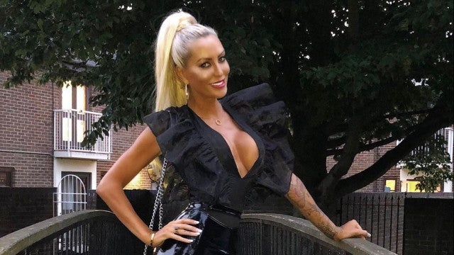 Ex-concorrente do ‘Big Brother’ é diagnosticada com tumor cerebral