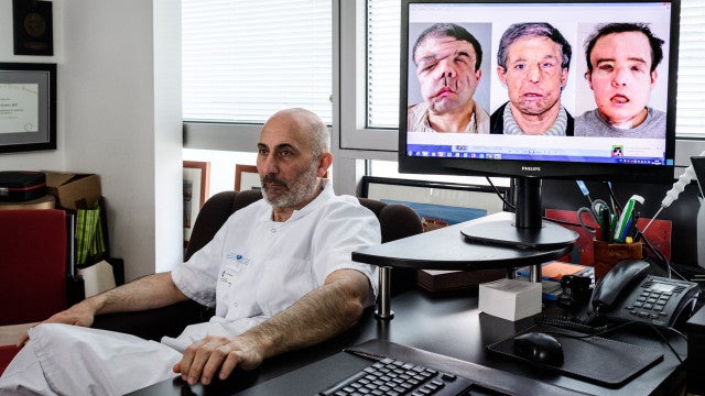 Morre o francês dos "três rostos"; Jérôme Hamon era "um lutador incrível"