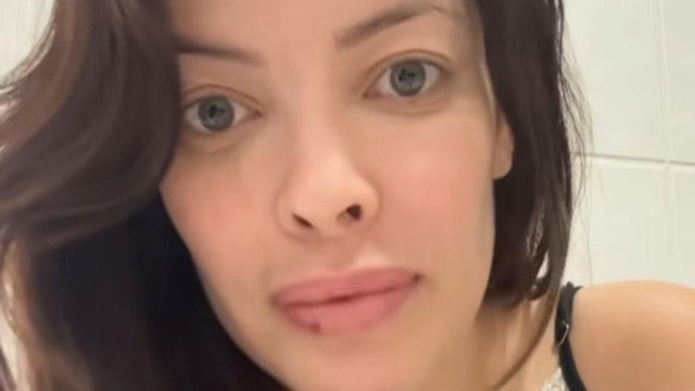 Após volutariado, Jaque rebate comentários de haters e mostra machucados