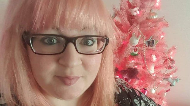 Mulher que sofria por ter ‘pernas de tronco de árvore’ descobre doença