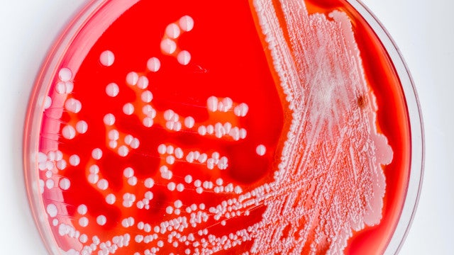 Bactéria "devoradora de carne" preocupa Japão: casos atingem recorde