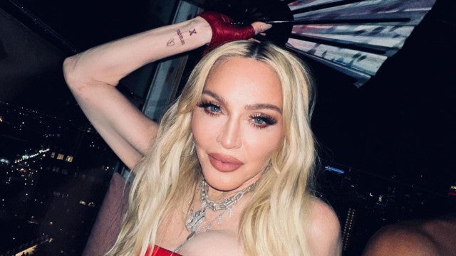 Há 1 ano, Madonna lutou pela vida; artista lembra "recuperação milagrosa"