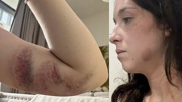 Comissária de bordo é presa em Dubai após denunciar marido por violência