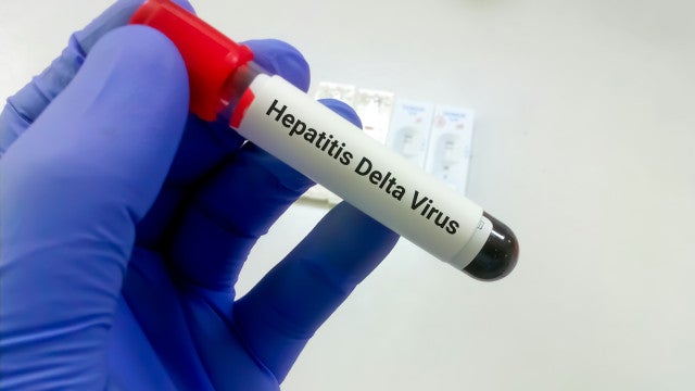 Hepatite Delta avança entre ribeirinhos no Amazonas