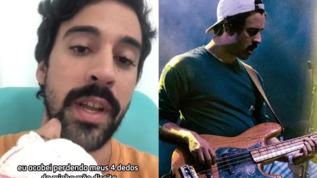 Baixista da banda Zimbra perde quatro dedos após sofrer acidente de buggy