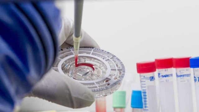 Laboratório na África do Sul abriga amostras de Ebola e outros vírus letais