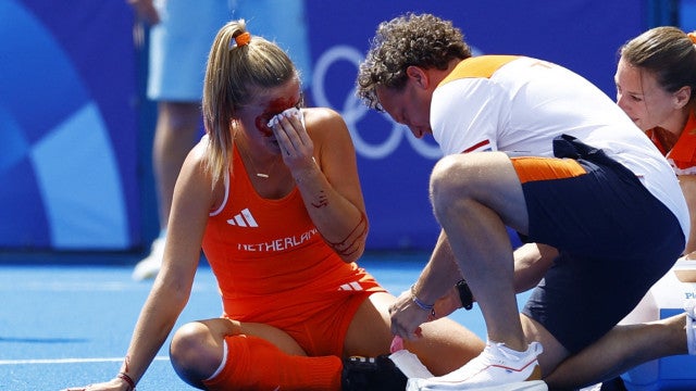 Atleta leva bolada no rosto e sangra muito na quadra; veja