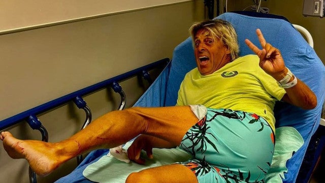 Surfista é mordido por tubarão e dirige até o hospital