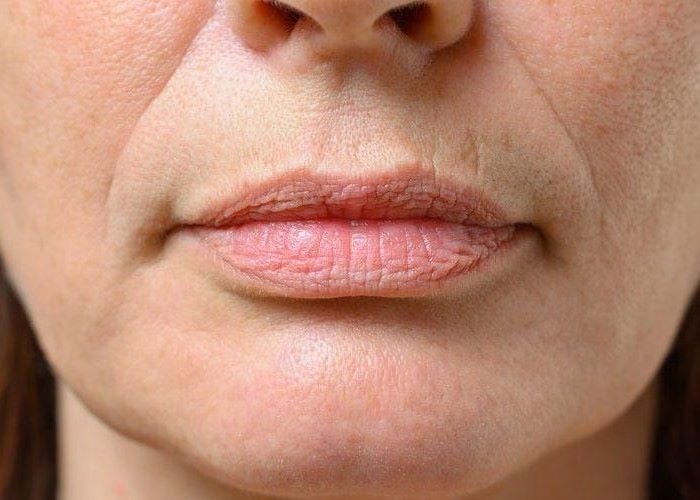 Bigode chinês: Saiba dicas de como evitar e técnicas que suavizam linha de expressão