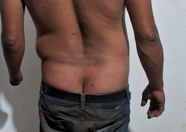 Homem é esfaqueado em bar e suspeito é preso pela Polícia Militar em Nova Santa Helena