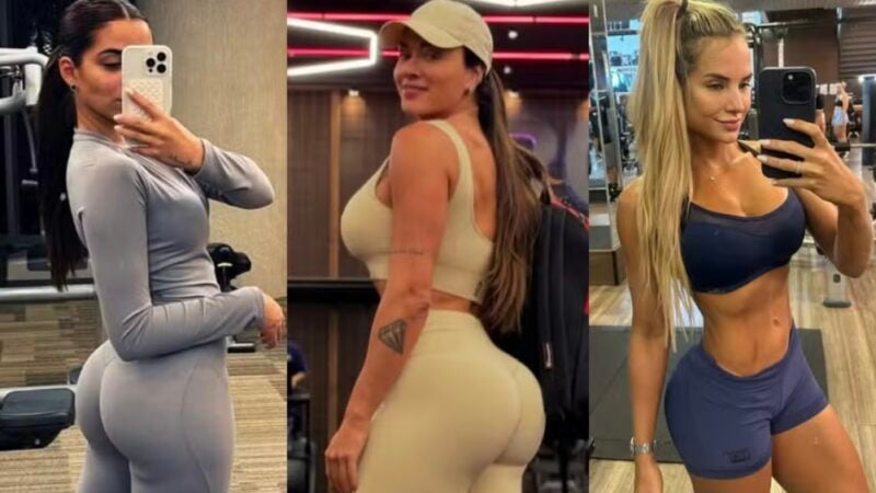 Famosas turbinam o bumbum: saiba a diferença entre harmonização e remodelação nos glúteos
