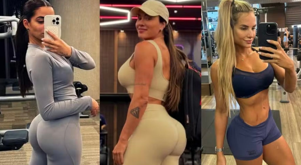 Famosas turbinam o bumbum: saiba a diferença entre harmonização e remodelação nos glúteos