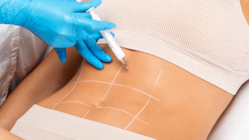 Como funciona a cirurgia que redefine o contorno corporal