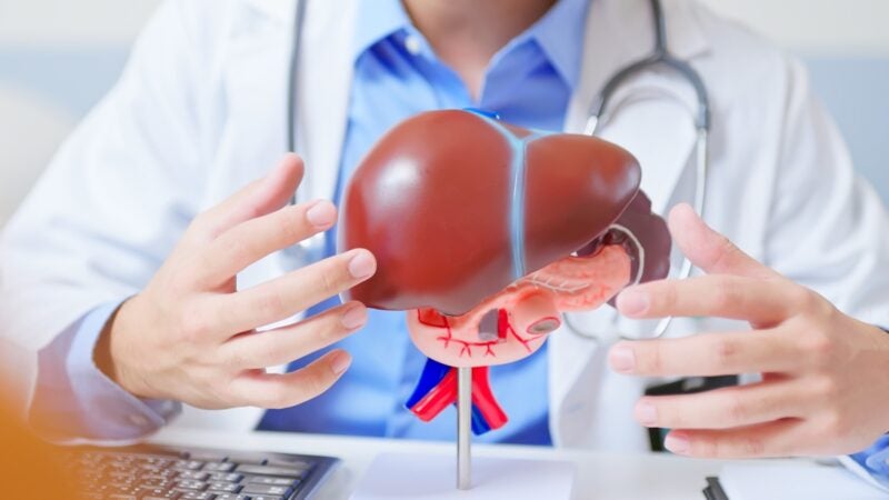 Gordura no fígado e Saúde Cardiovascular