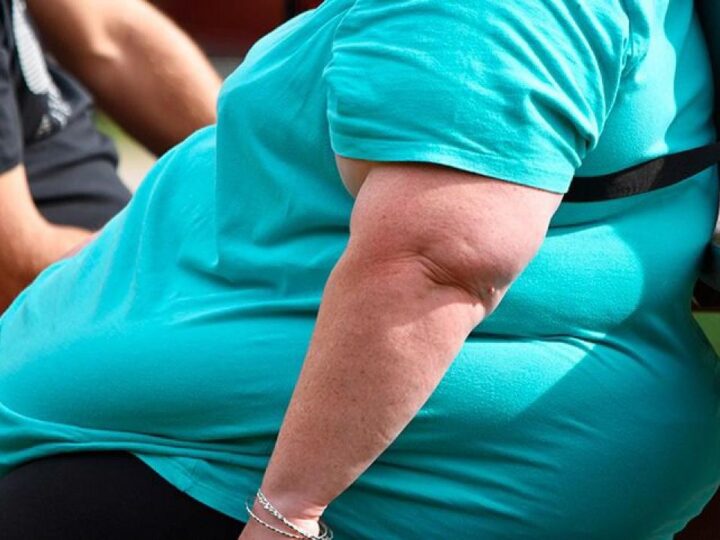 Estudo global; a obesidade se tornou o maior fator de risco para a saúde no Brasil