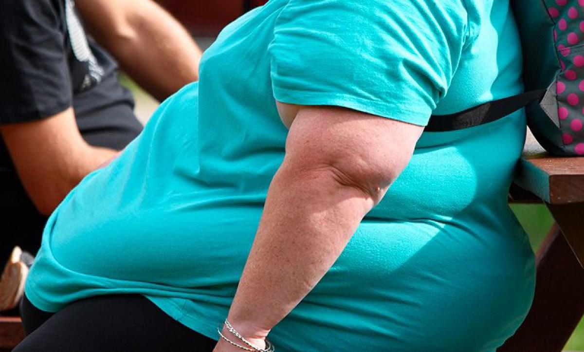 Estudo global; a obesidade se tornou o maior fator de risco para a saúde no Brasil