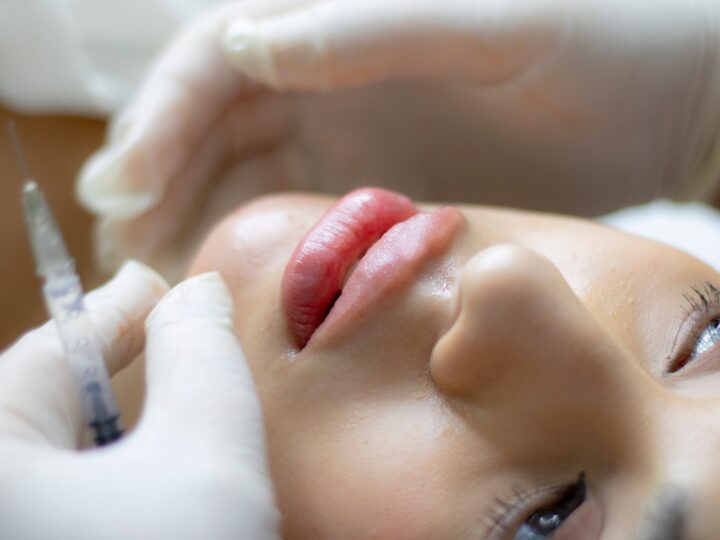 Botox preventivo e terapêutico: quando é indicado e quais cuidados tomar