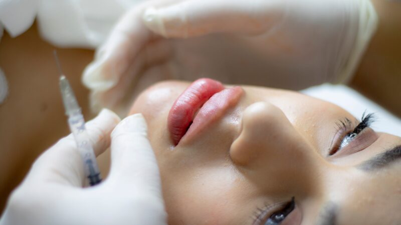 Botox preventivo e terapêutico: quando é indicado e quais cuidados tomar